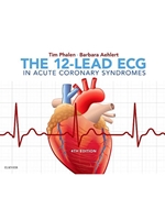 (EBOOK) THE 12-LEAD ECG IN ACUTE CORONARY SYNDROMES